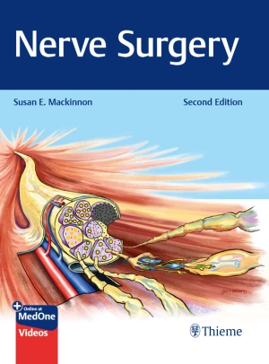 Nerve Surgery